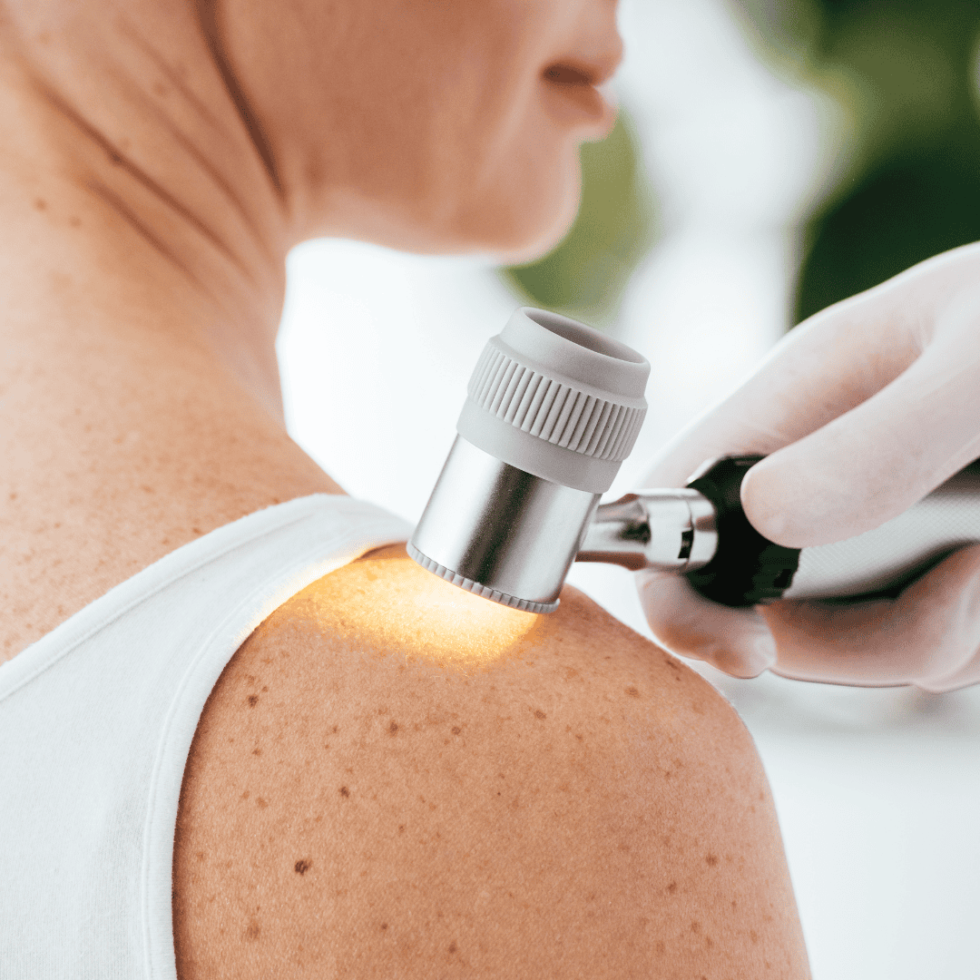 Dermatology 15 - Madelia Health