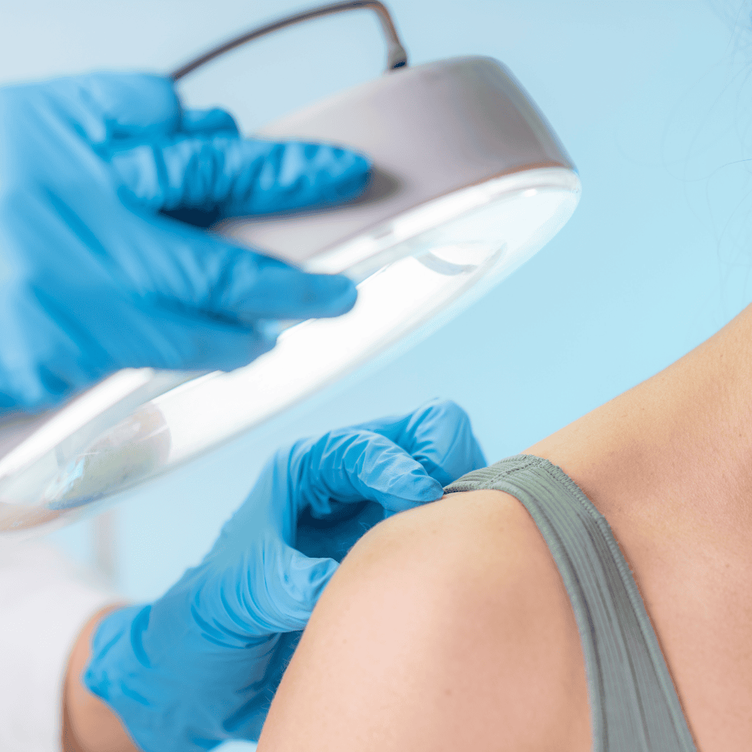 Dermatology 16 - Madelia Health