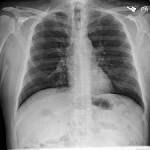Radiography Radiography