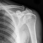 Radiography Radiography